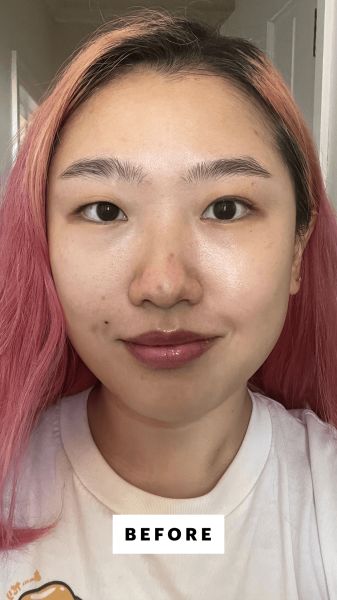 Han before applying the CosRx BHA Blackhead Power Liquid Treatment