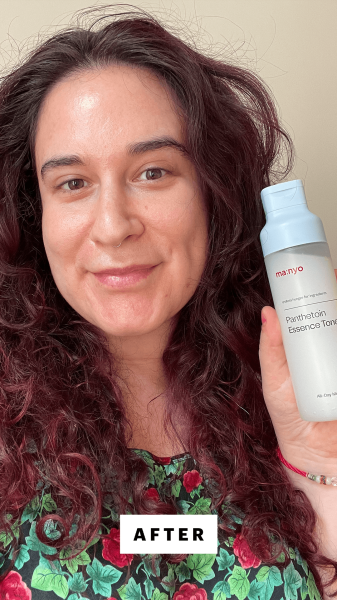 Allure contributor Devon Abelman after applying the Manyo Panthetoin Essence Toner